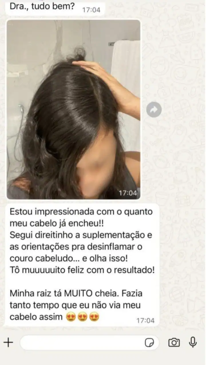 Depoimento WhatsApp: cliente impressionada com raiz cheia